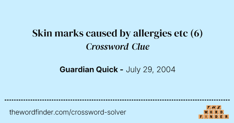 Skin marks caused by allergies etc crossword clue image